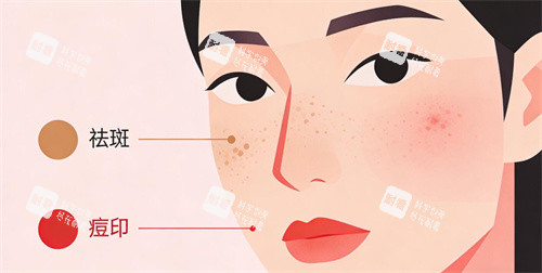 卡通痘印祛斑照片