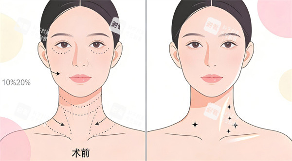 颈部提升整形手术前后对比