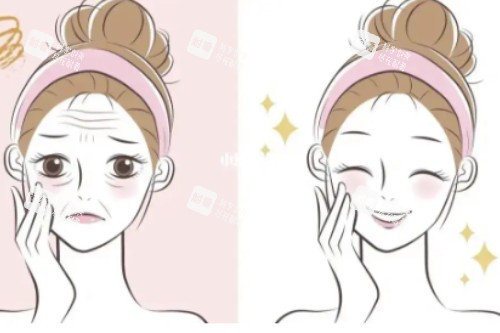 面部状态提升对比图