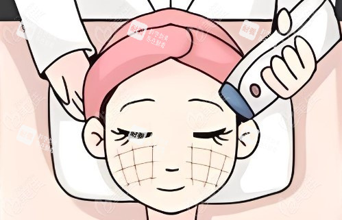 热玛吉操作过程