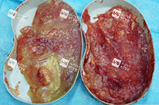 奥美定组织照片