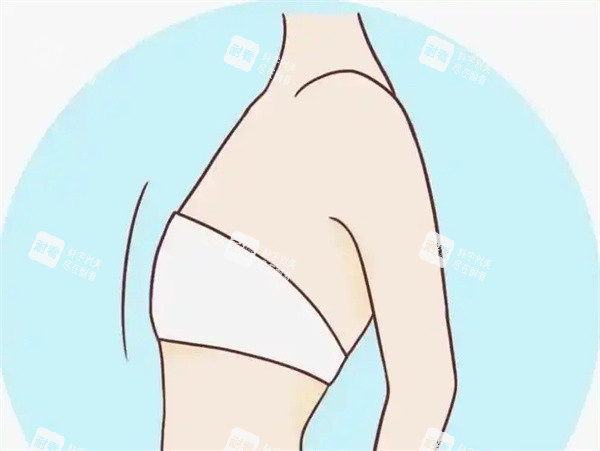 胸部缩小术