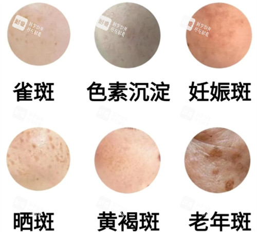 不同的皮肤斑点