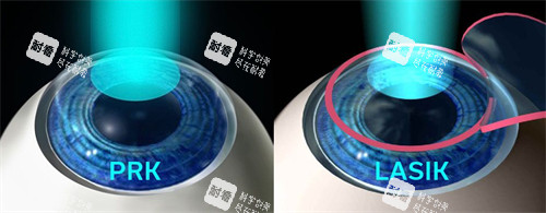 表层手术不同 表层手术不同