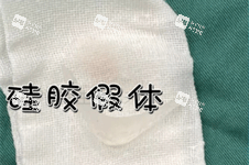 硅胶下巴假体照片
