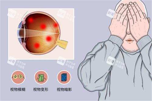 眼底病症状示意图 眼底病症状示意图