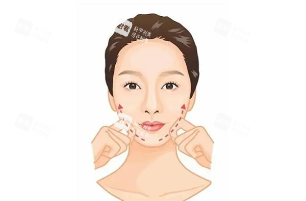 面部 提升效果图