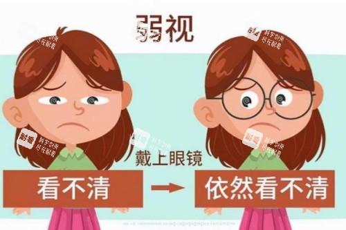 弱视卡通示意图 弱视卡通示意图