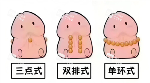 入珠手术动画2