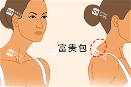 富贵包所在位置图解
