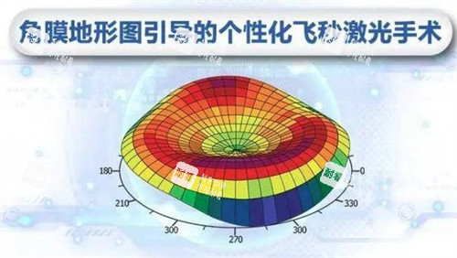 个性化飞秒激光手术 个性化飞秒激光手术