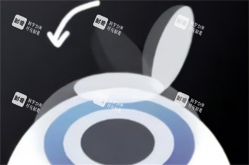 半飞秒盖回角膜瓣