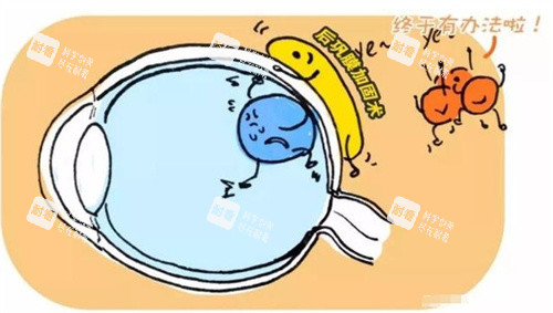 后巩膜加固术图片