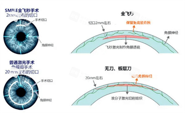 全飞秒卡通图