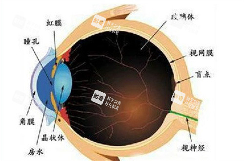 继发性青光眼