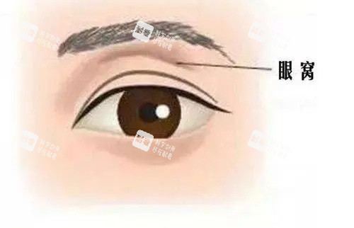 眼窝的示意图