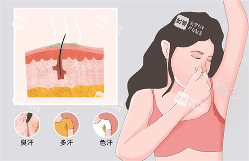 狐臭有哪些症状 狐臭有哪些症状