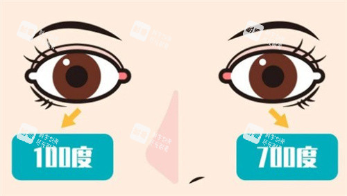 两眼度数差距大