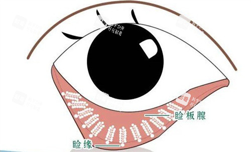 睑板腺 睑板腺