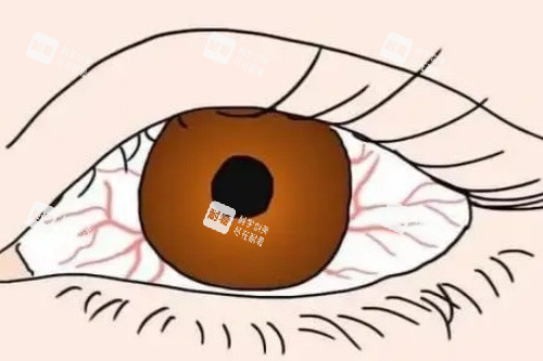 眼睛充血卡通图