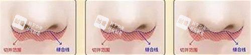 人中照片