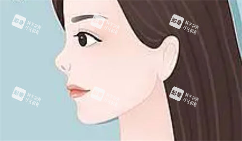 朝天鼻侧面动画展示图