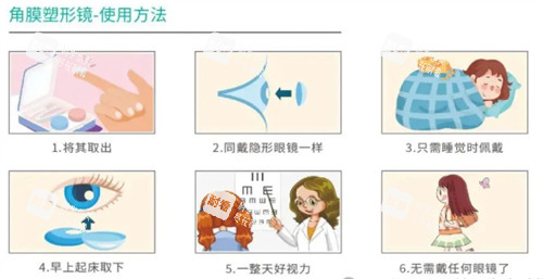 角膜塑形镜使用方法.jpg 角膜塑形镜使用方法.jpg