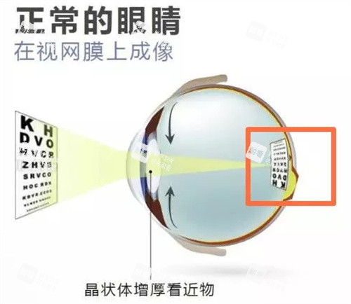 正常眼睛看到的样子 正常眼睛看到的样子