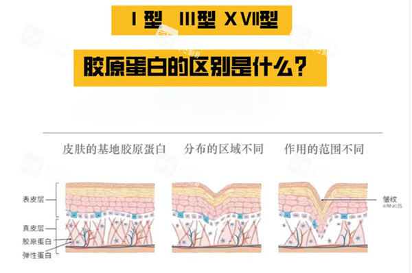 胶原蛋白一型和三型对比区别 胶原蛋白一型和三型对比区别