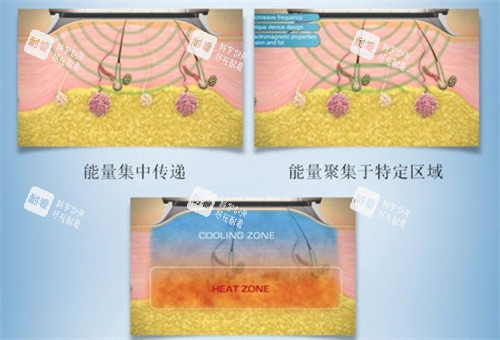 清新微波工作原理 清新微波工作原理