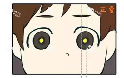 正常的眼睛 正常的眼睛