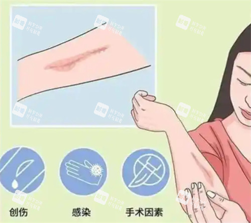 造成疤痕的原因