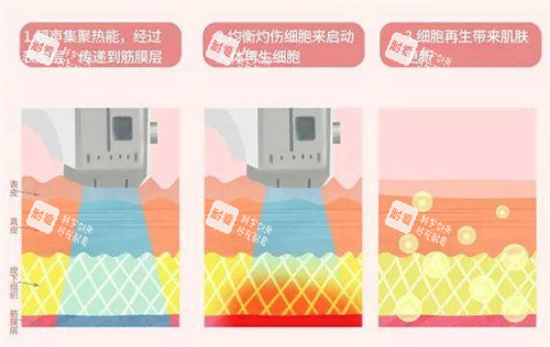 超声波原理