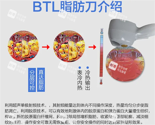 溶脂刀仪器作用图解 溶脂刀仪器作用图解