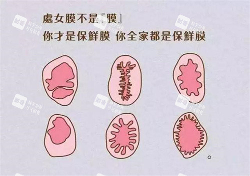 处女膜形状动画演示图 处女膜形状动画演示图