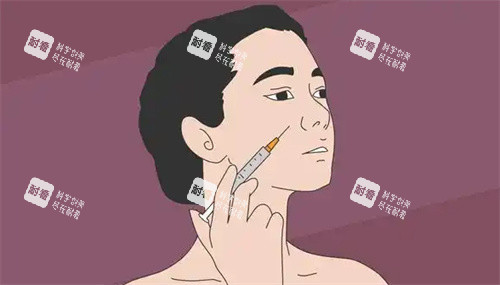 面部注射图 面部注射图