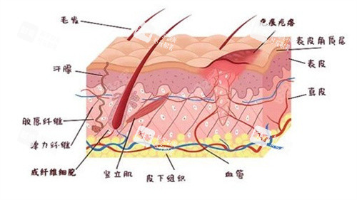 疤痕增生原理 疤痕增生原理