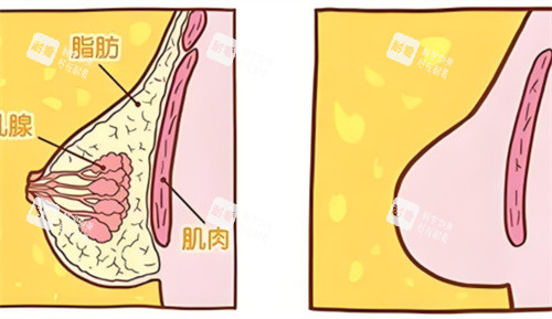乳房组织 乳房组织