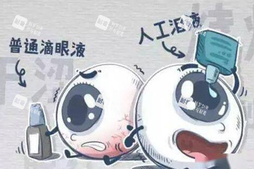 干眼症有哪些办法可以解决 干眼症有哪些办法可以解决