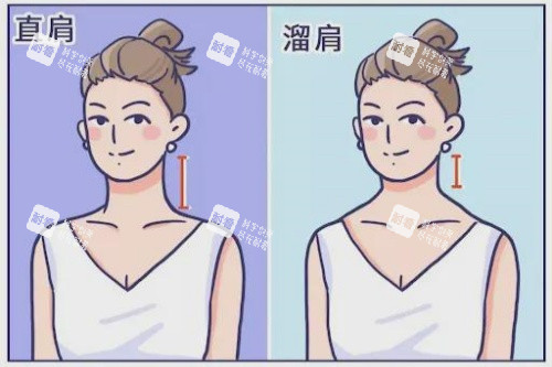 溜肩直角肩卡通图.jpg