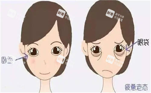 卧蚕手术对比
