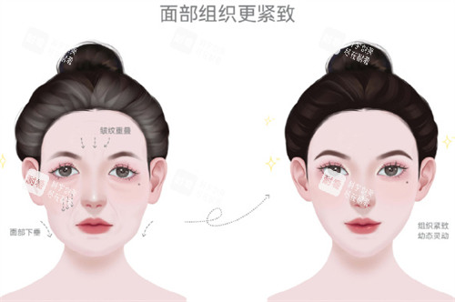耳基底填充前后对比
