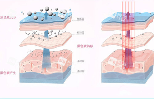 皮肤美白内部作用层次示意图 皮肤美白内部作用层次示意图
