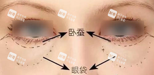眼周组织图