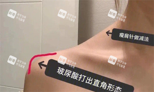 直角肩塑造要点 直角肩塑造要点