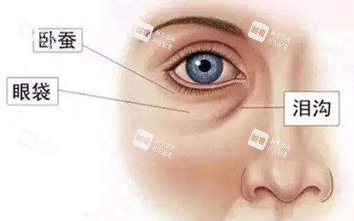眼周不同结构及名称示意图 眼周不同结构及名称示意图