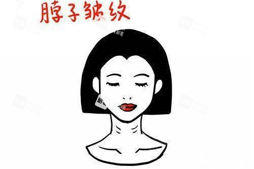 脖子皱纹卡通图 脖子皱纹卡通图