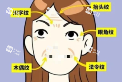 面部皱纹详细示意图 面部皱纹详细示意图