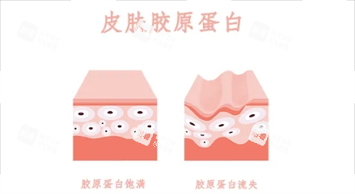 胶原蛋白在皮肤表面的动画示意图 胶原蛋白在皮肤表面的动画示意图