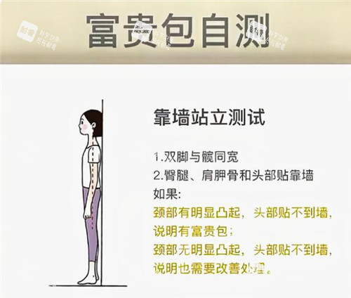 富贵包自测 富贵包自测